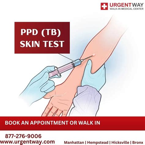 walgreens ppd test|TB (Tuberculosis) Test: Purpose, Procedure & Results.